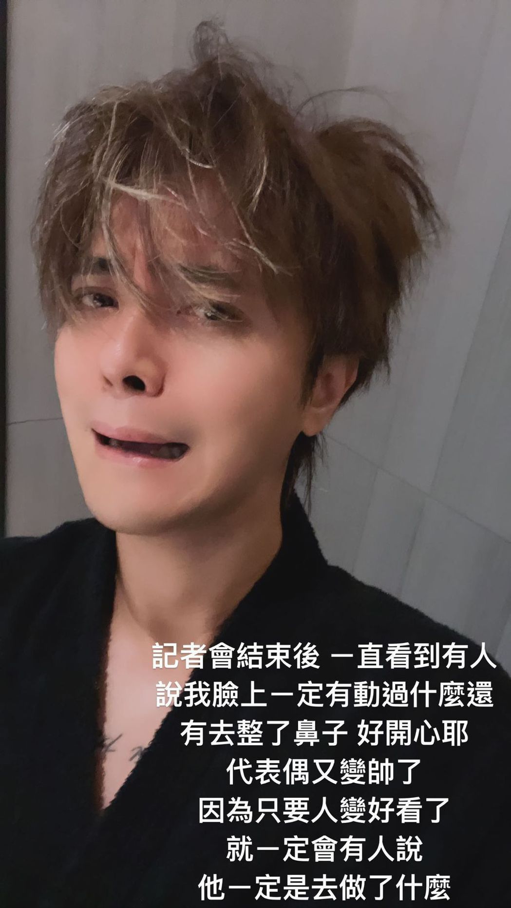 罗志祥记者会被质疑整鼻、打肉毒认「脸僵」亲曝原因