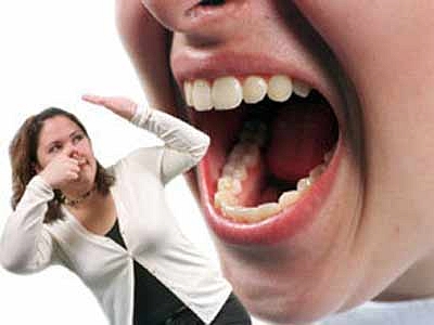 孕妇口臭是何因?孕期口臭该如何预防和治疗?