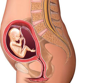 引产不等于流产，告诉你引产那些不为人知的事