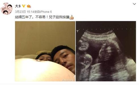 大s自曝怀男胎,透露产后保养心得