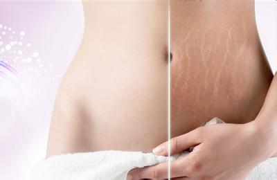 鸡蛋去除妊娠纹真的有效吗？