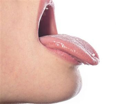 舌苔厚白吃什么药