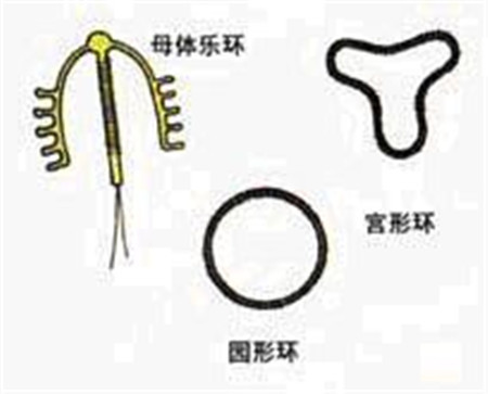 上环分几种环