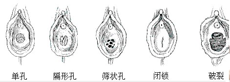 揭开:女性生理生殖器羞于启齿的秘密