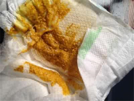 新生儿大便颜色对照表，史上最全的便便对照表