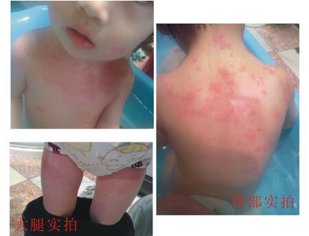 电热驱蚊液对宝宝有害吗2 电热驱蚊液对宝宝有害吗 宝宝用电热驱蚊液好吗