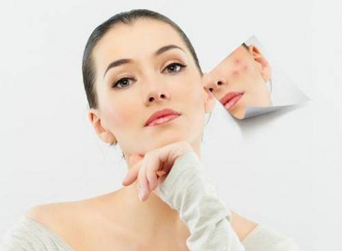 如何祛除脸上的雀斑 教你几个小方法