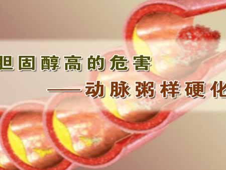 胆固醇高的原因?胆固醇高的危害?胆固醇高吃什么好