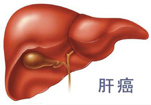 甲胎蛋白的正常值是多少?6种甲胎蛋白偏高的调养方法