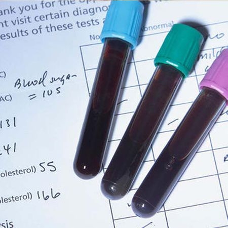 胆固醇高难怀孕?备孕如何对待胆固醇?