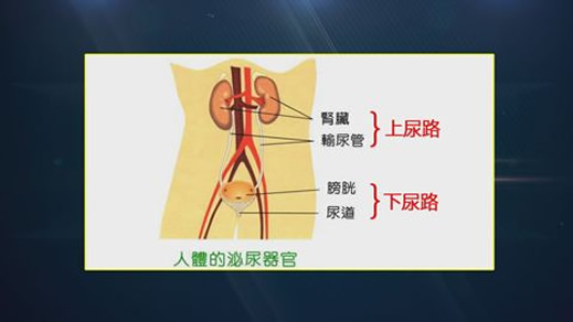 女性尿路感染是怎么引起的：女性尿路感染怎么办