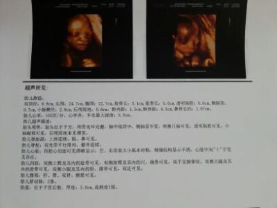 生男生女早知道，一分钟教你看懂四维彩超