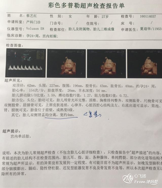 生男生女早知道，一分钟教你看懂四维彩超