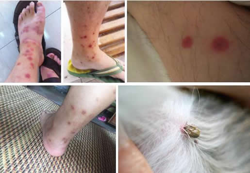 跳蚤咬过后的怎么处理：家里灭跳蚤有效6大方法