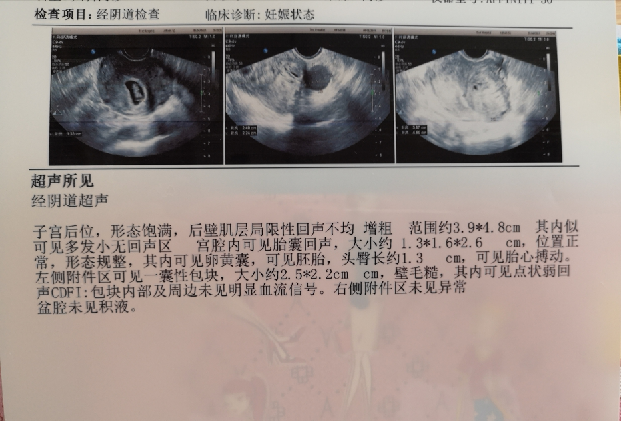 接好孕!备孕两年,终于自然怀孕,接到了自己的宝宝