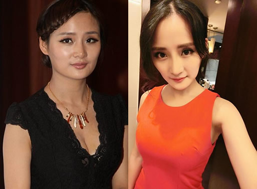 中国女明星隆胸:明星隆胸了,公开承认隆胸10位女明星