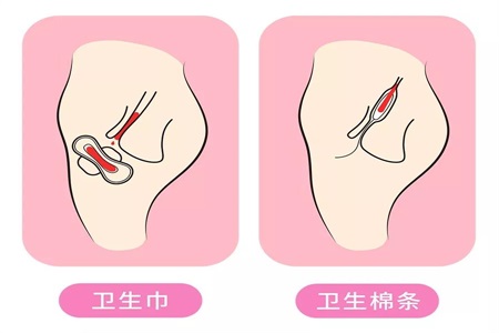 卫生棉条解放女性自由 许多人却担心它会弄破处女膜?