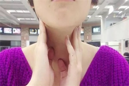 甲亢症状有哪些 女性要清楚甲亢和甲状腺结节的差别