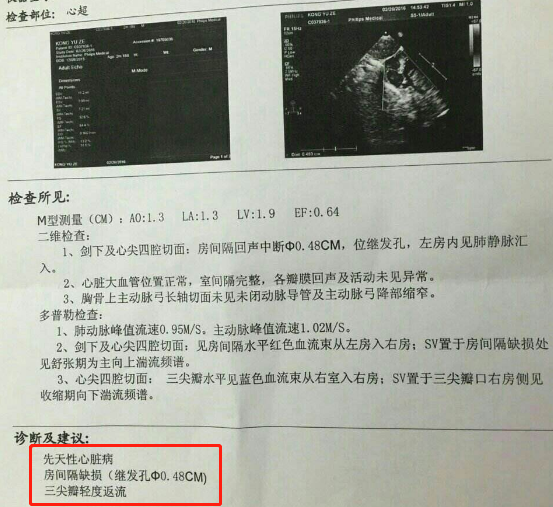 整个孕期做几次B超、每次检查时间及检查内容，孕妈收藏