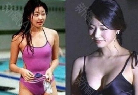 宣美否认隆胸传闻始末:扒一扒胸部从A到C的韩国女星 宣美否认隆胸传闻始末:扒一扒胸部从A到C的韩国女星