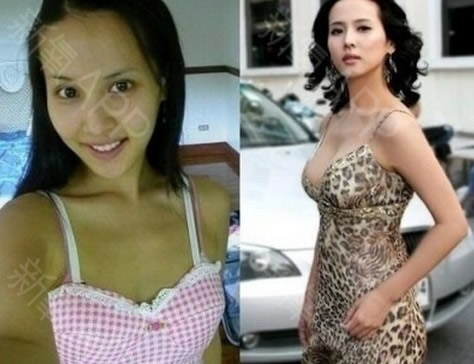 宣美否认隆胸传闻始末:扒一扒胸部从A到C的韩国女星 宣美否认隆胸传闻始末:扒一扒胸部从A到C的韩国女星