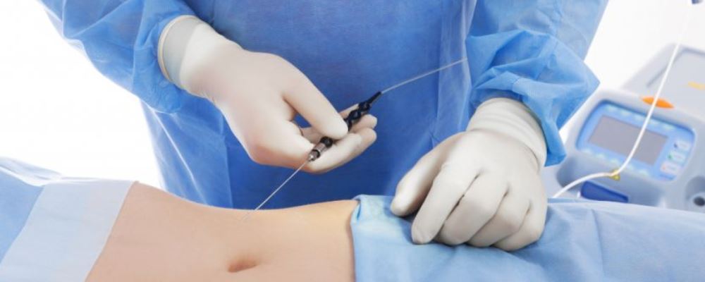 最有效的瘦肚子方法 肚子大的人试试