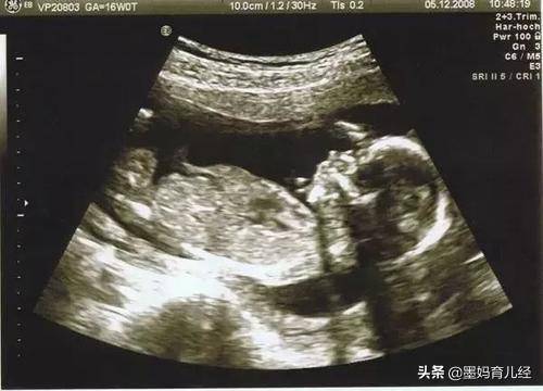 孕19周自然流产的原因是什么?怀孕初期避免流产的方法