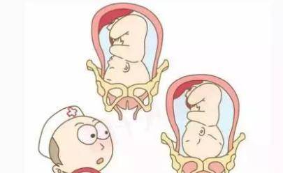 什么情况要做剖腹产?剖腹产术前准妈妈注意事项
