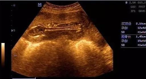 九个最准怀男孩征兆:前三个月生男孩9大征兆