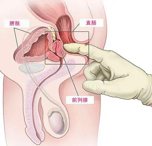 传说中的前列腺快感是真实存在的吗?究竟如何实现?