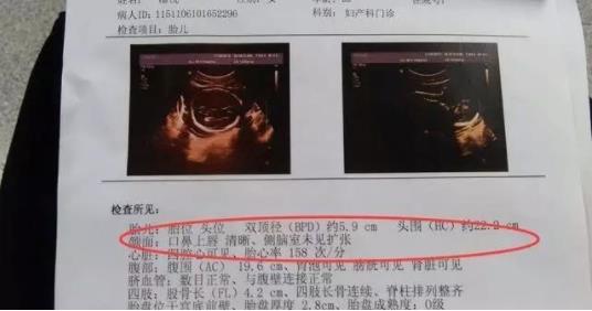 九个最准怀男孩征兆：前三个月生男孩9大征兆