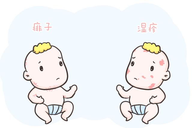 湿疹、痱子傻傻分不清?一篇教你正确区分与治疗,有需要的快收藏