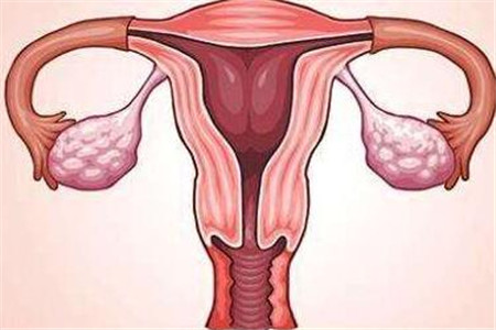 女人子宫最容易出现的四种疾病