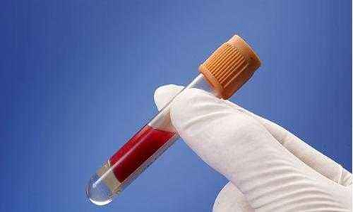 乙肝表面抗体阳性是什么意思？乙肝表面抗体阳性要注意三点