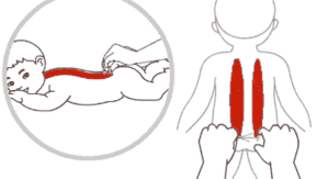 【小儿大脑发育不全推拿方法有哪些】小儿推拿脑发育不全的方法是什么
