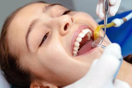 洗牙能让牙齿变白吗 1次洗牙能改变什么要多少钱