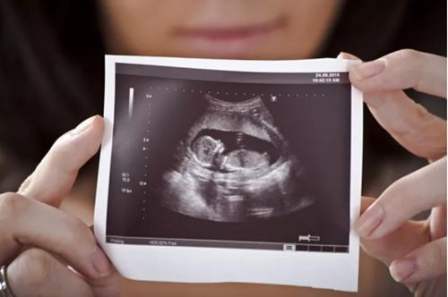 四维单子怎么看男孩女孩?3秒教你看男孩女孩!