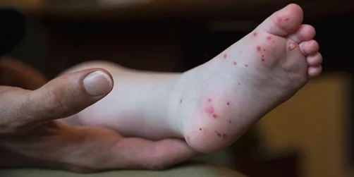 打过疫苗也没有绝对的终身免疫,想让孩子少生病,一定要做好这几点！