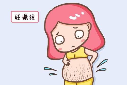 妊娠纹去不掉吗?如何预防妊娠纹的出现?
