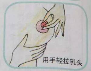 乳头内陷也可以纯母乳喂养？是的！
