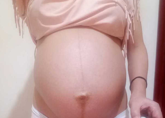 孕囊形状可以察男女？孕囊形状受它影响,别疏忽