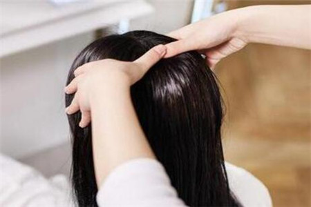 女人脱发严重的护理小技巧