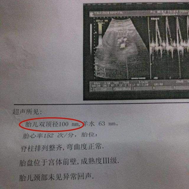 想顺产胎儿的双顶径有何要求？最好别超出此范围,否则分娩风险大