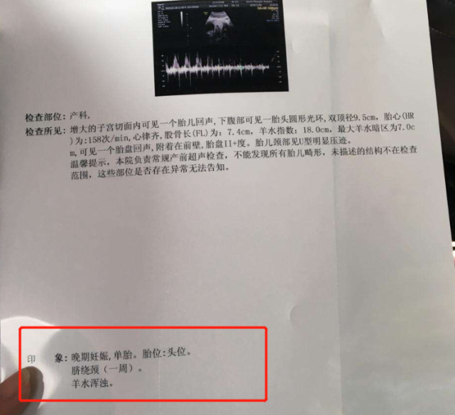 怀孕后,4个＂不良习惯＂可能会让羊水变浑浊,孕妈别大意