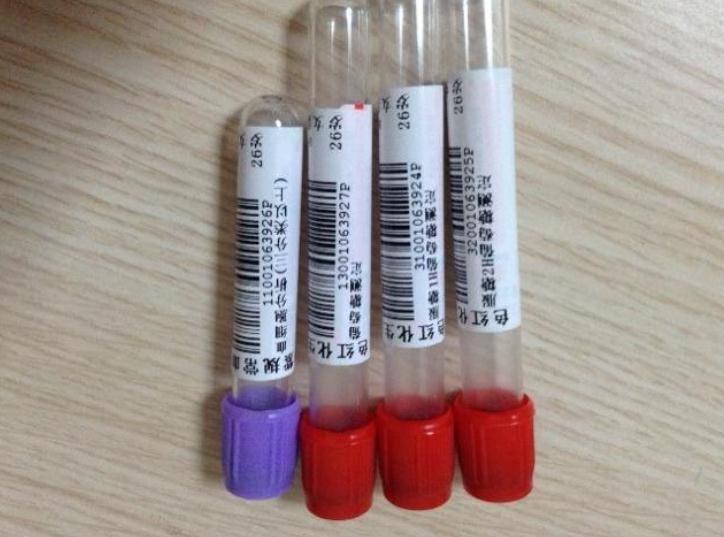 孕期哪些产检项目最＂磨人＂？宝妈答案惊奇的一致,过来人都懂