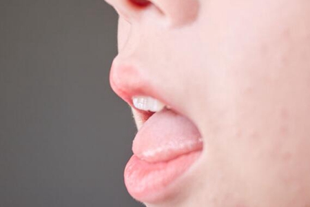 舌头有裂纹是怎么回事？舌头上有红色的小肉粒