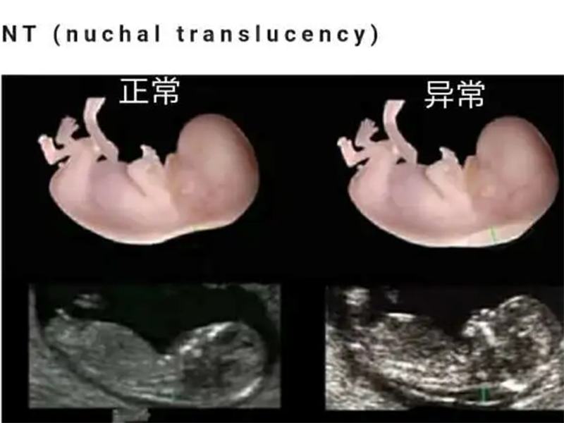 孕妇的NT检查,是上午去比较好还是下午去比较好？为什么？