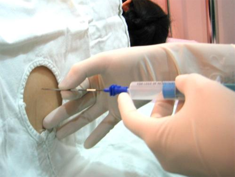 剖腹产只是＂挨一刀＂吗？术后恢复期有哪些要注意的？