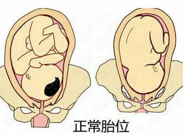 女人生产如何缩短加快产程呢？月子又有哪些不能碰的禁忌呢？