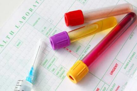 肝功能检查哪些项目？这三个肝功能检查重要意义